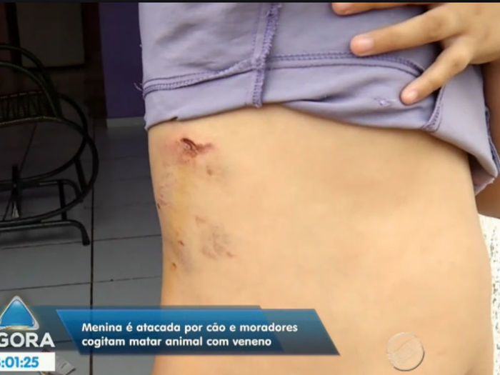 Criança é atacada por cão (Crédito: Reprodução TV Meio Norte )