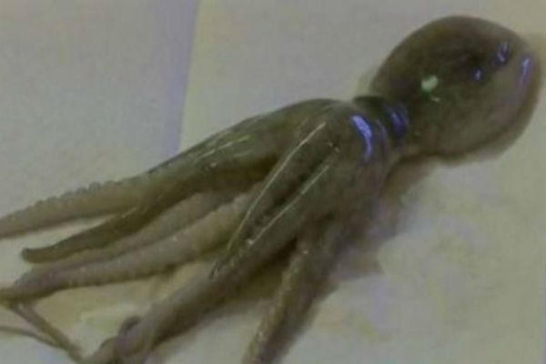 Polvo de 5cm foi encontrado na garganta de uma criança, na cidade de Wichita (EUA). (Crédito: Reprodução)
