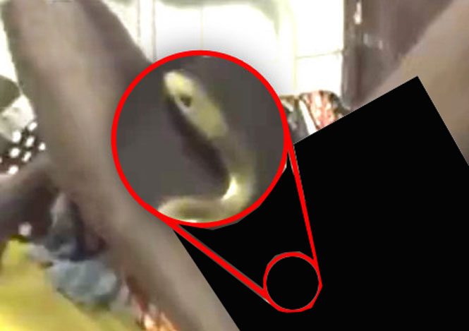 Vídeo flagra cobra viva presa na vagina de paciente na África (Crédito: Reprodução)