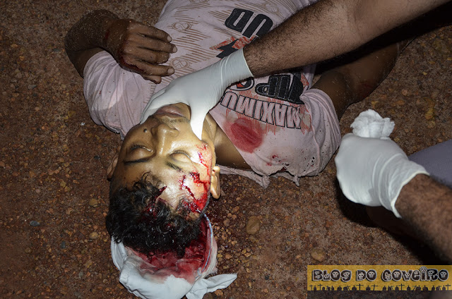 Motociclista ferido em acidente (Crédito: Reprodução)