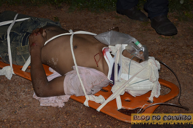 Motociclista ferido em acidente (Crédito: Reprodução)