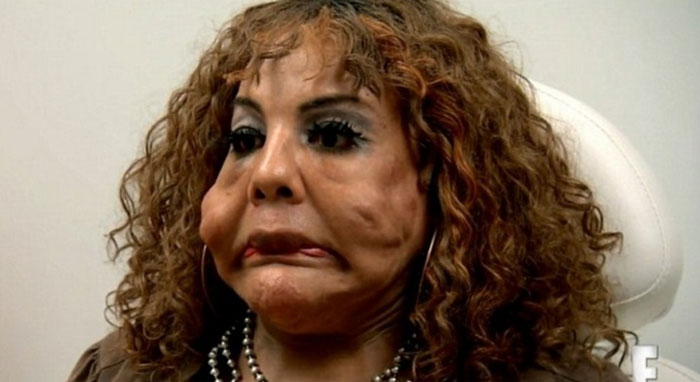 Teansexual ficou com rosto deformado (Crédito: Divulgação)