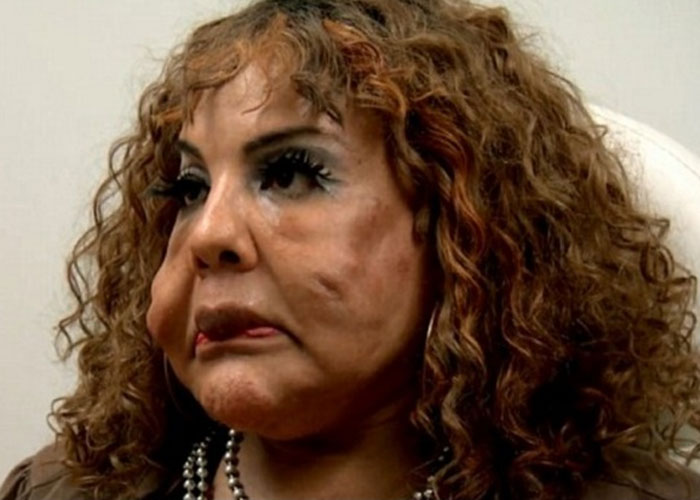 Teansexual ficou com rosto deformado (Crédito: Divulgação)
