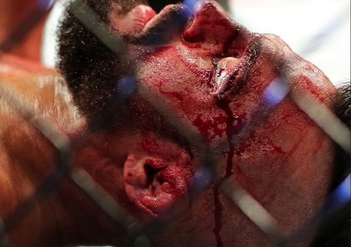 Vitor Belfort foi massacrado por Jacaré (Crédito: Reprodução)