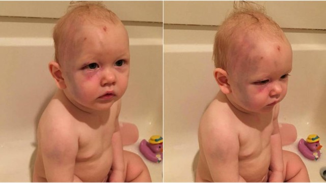 Bebê de um ano é espancando por babá e família luta por justiça (Crédito: Reprodução)