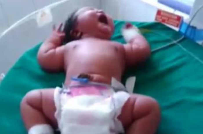 Bebê nasceu com 6,8kg na Índia