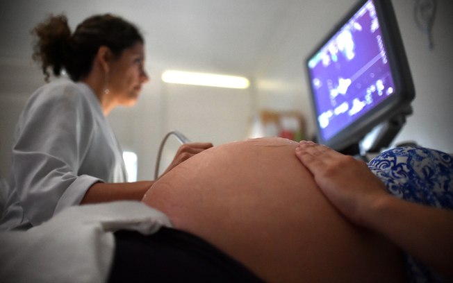 O Brasil é o país mais afetado pelos casos de microcefalia