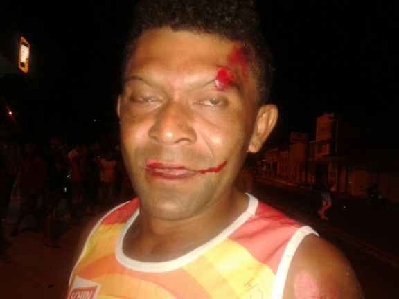 O condutor da moto também foi levado ao hospital antes da detenção