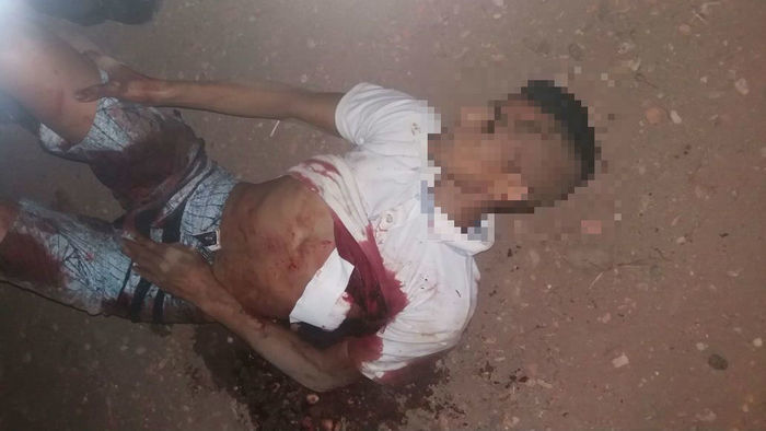 Assaltante baleado no Dirceu (Crédito: Reprodução)