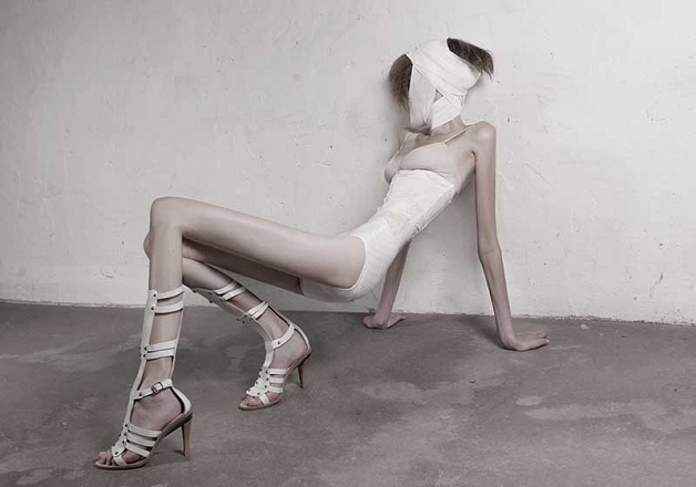 Sessão de fotos sobre anorexia (Crédito: Reprodução)