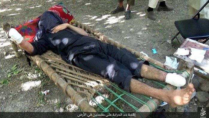 Homem teve pés e mãos decepados