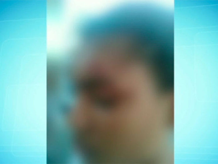 Adolescente de 16 anos é baleada com 8 tiros por ex namorado (Crédito: Reprodução)