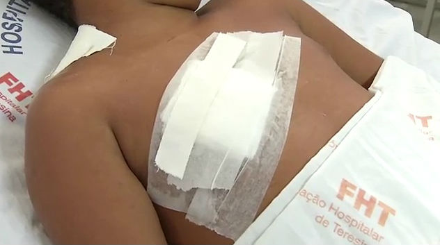 Garoto fez cirurgia no Hospital de Urgência de Teresina (HUT)