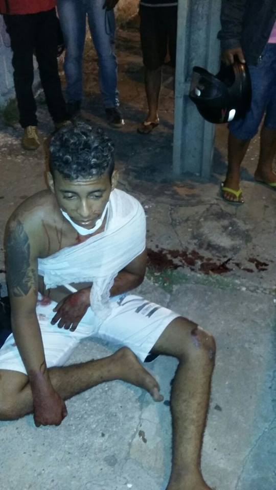 Bandido fica ferido após tentar assaltar loja na z.Leste de THE (Crédito: Reprodução)
