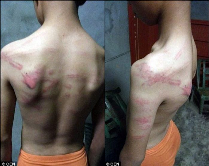 Garoto foi espancado por professor