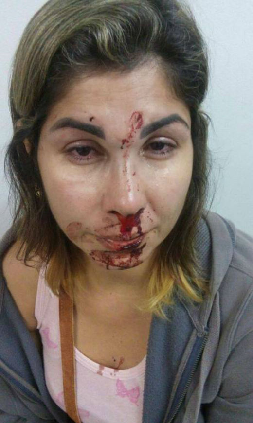 Garoto publicou foto da mãe agredida pelo marido