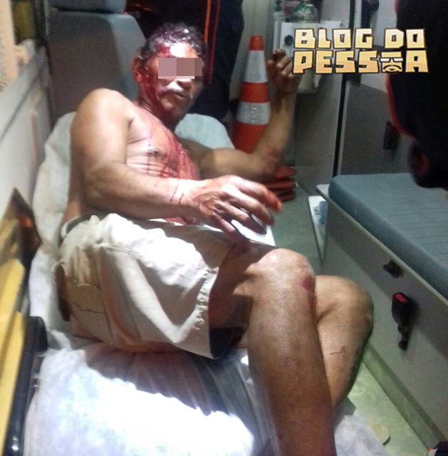 Vigia foi agredido em ação (Crédito: Reprodução)