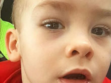 Filho de Ana Hickmann sofre acidente e leva pontos no rosto