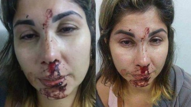 Filho fez post da mãe com o rosto ensanguentado no Facebook