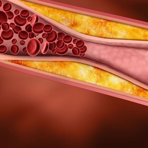 Saiba 17 fatos curiosos sobre o colesterol