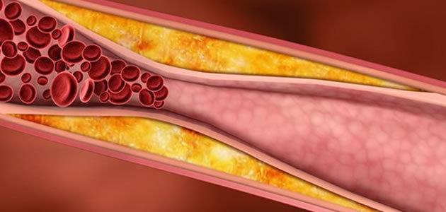 Saiba 17 fatos curiosos sobre o colesterol