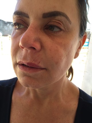 Flor fica machucada após ter chácara invadida e lutar com bandido