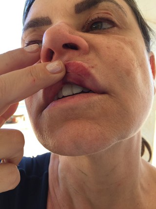 Flor foi agredida na boca pelo bandido