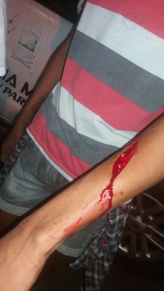 Garoto foi atingido em Parnaiba (Crédito: Reprodução)
