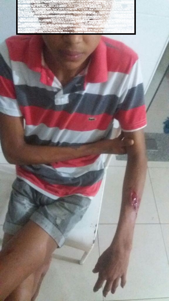Garoto foi atingido em Parnaiba (Crédito: Reprodução)