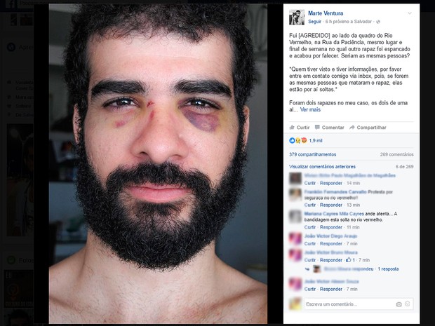 Cantor detalha agressão (Crédito: Reprodução)