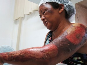 Deuzilene Antônia da Silva de 42 anos (Crédito: Reprodução)