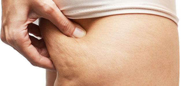 7 alimentos que favorecem o aparecimento das celulites