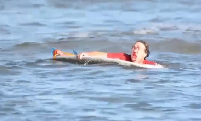 Surfista foi atacado por crocodilo