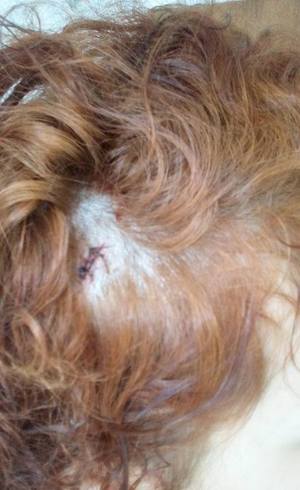 Mulher é agredida por estar andando com amigos gays em SP (Crédito: Reprodução)