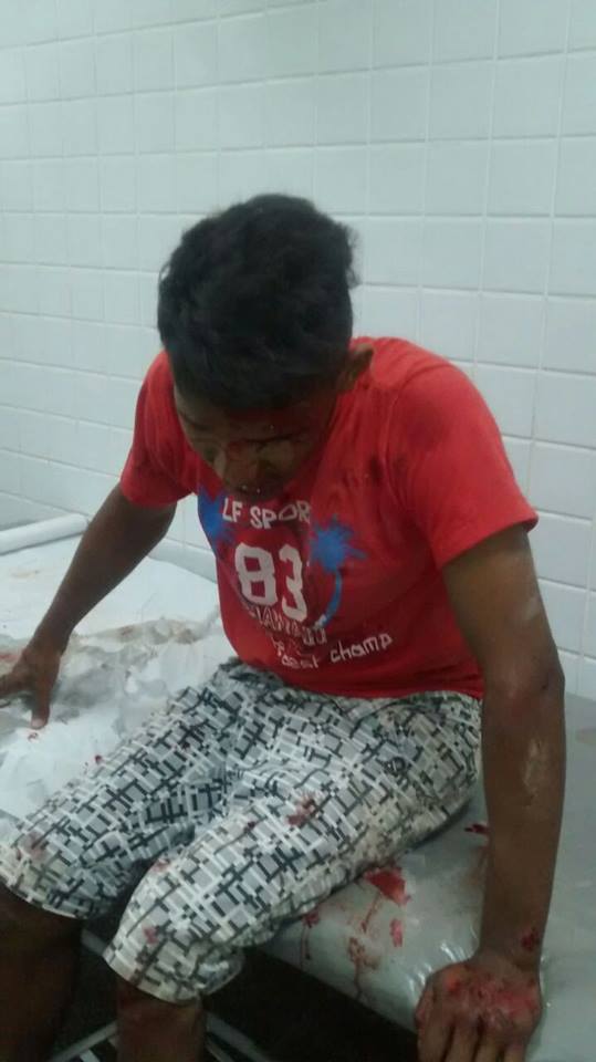 Jovem fica gravemente ferido durante perseguiçãp policial (Crédito: ReproduçÃO)