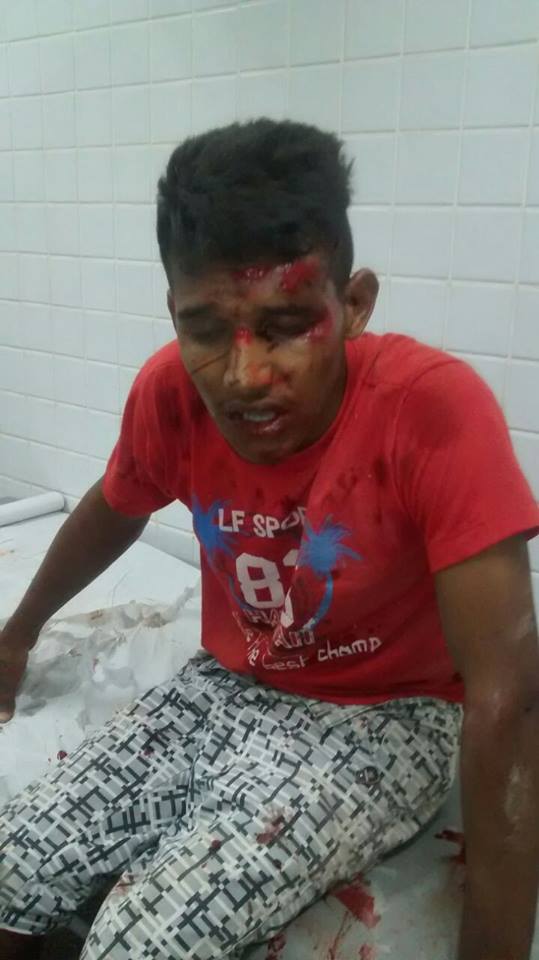 Jovem fica gravemente ferido durante perseguiçãp policial (Crédito: ReproduçÃO)