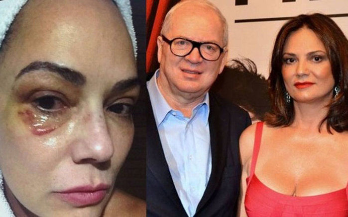 Luiza Brunet diz que foi agredido pelo marido (Crédito: Divulgação)