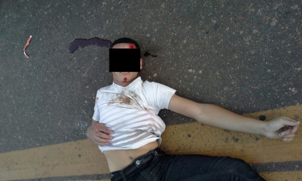 Jovem ficou gravemente ferido (Crédito: Reprodução)