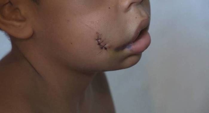 Menino de sete anos é espancado pela madrasta em Manaus (Crédito: Reprodução)