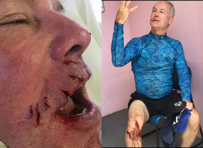 Homem é atacado por tubarão e descreve momento de terror (Crédito: Reprodução)