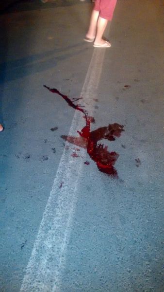 Homem ficou ferido com acidente (Crédito: Reprodução)