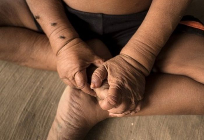 Menino de quatro anos chama atenção por ter aparência 80 anos (Crédito: Reprodução)