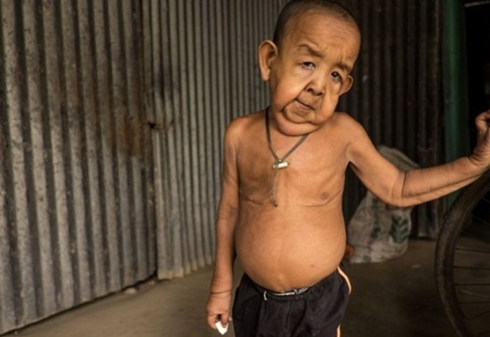 Menino de quatro anos chama atenção por ter aparência 80 anos (Crédito: Reprodução)