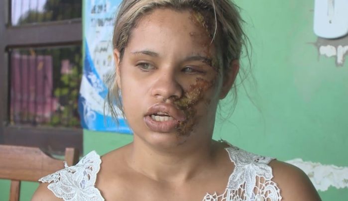 Homem agride ex-mulher e deformada rosto da vítima após discussão (Crédito: Reprodução)