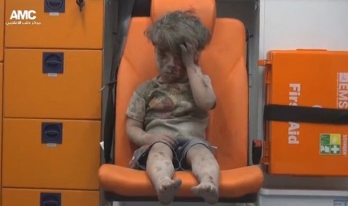 Omran Daqneesh, de cinco anos (Crédito: Reprodução)