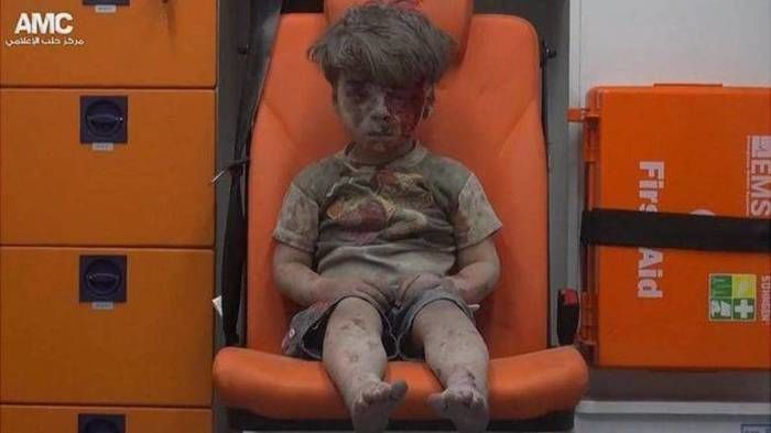 Omran Daqneesh, de cinco anos (Crédito: Reprodução)
