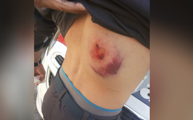 Policial foi alvejado com tiros nas costas