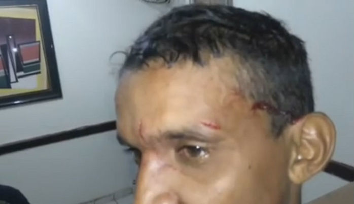 Jovem agredido (Crédito: Reprodução)