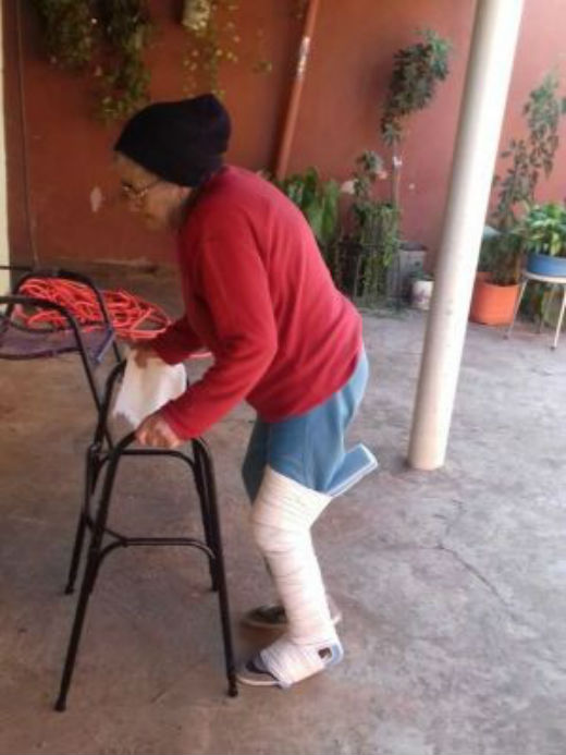 Maria Ivone teve a perna enfaixada por cima da calça e do tênis que usava nahora do atendimento