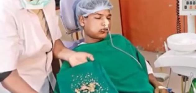 Médicos removem 232 dentes de mandíbula de jovem